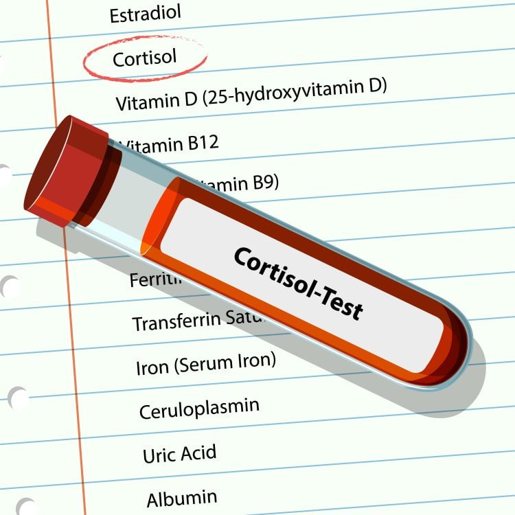 Vector image of cortisol test and medical list